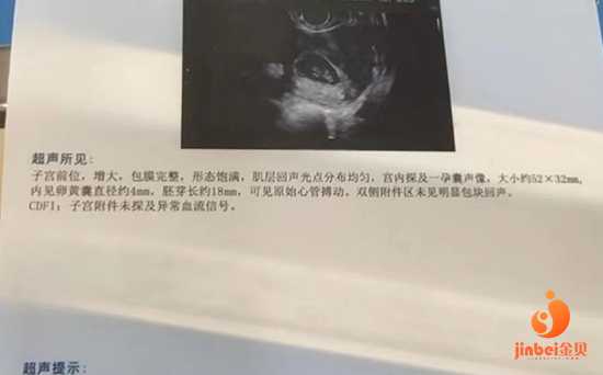 切除子宫卵巢试管_阴道生孩子视频_广州最靠谱的供卵试管机构怎么选择？