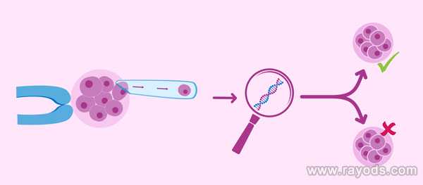 因染色体异常胎停_自然流产的原因_泰国第三代试管婴儿的流程时间表是什么样