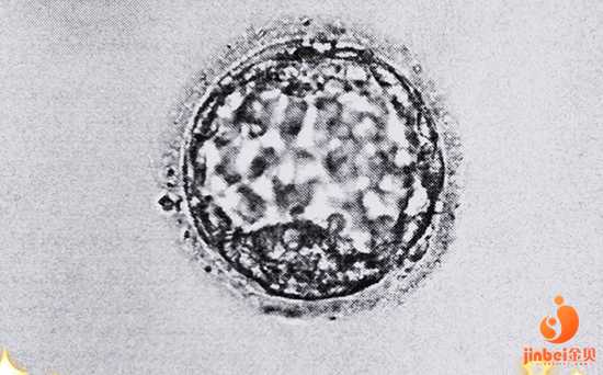 切除子宫纵隔怀孕_流产物染色体异常_38岁输卵管积水成功试管案例分享